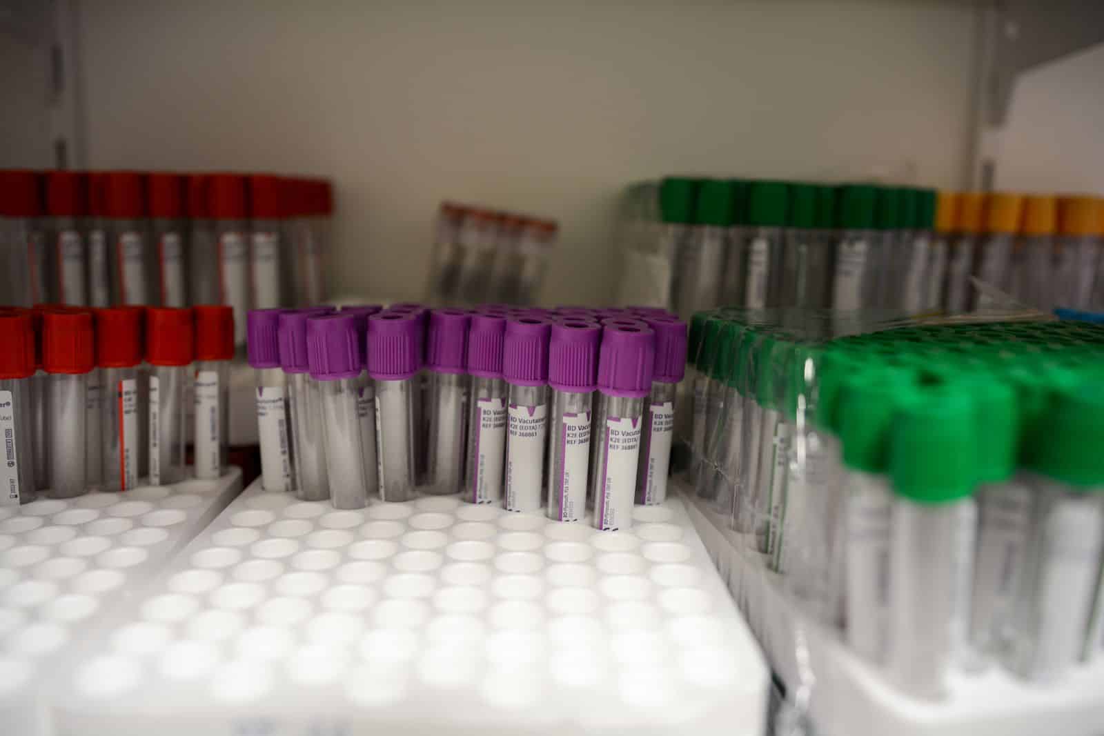 Blood collection tubes ready for laboratory analysis